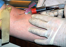 Blutentnahme beim Menschen, Quelle: Wikimedia Commons